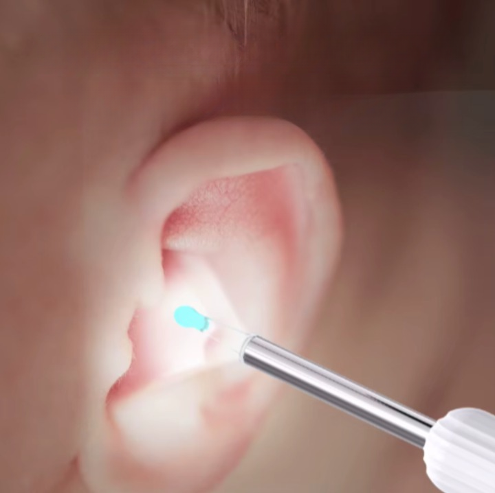 Nettoyeur Auriculaire Connecté – Compatible iOS & Android