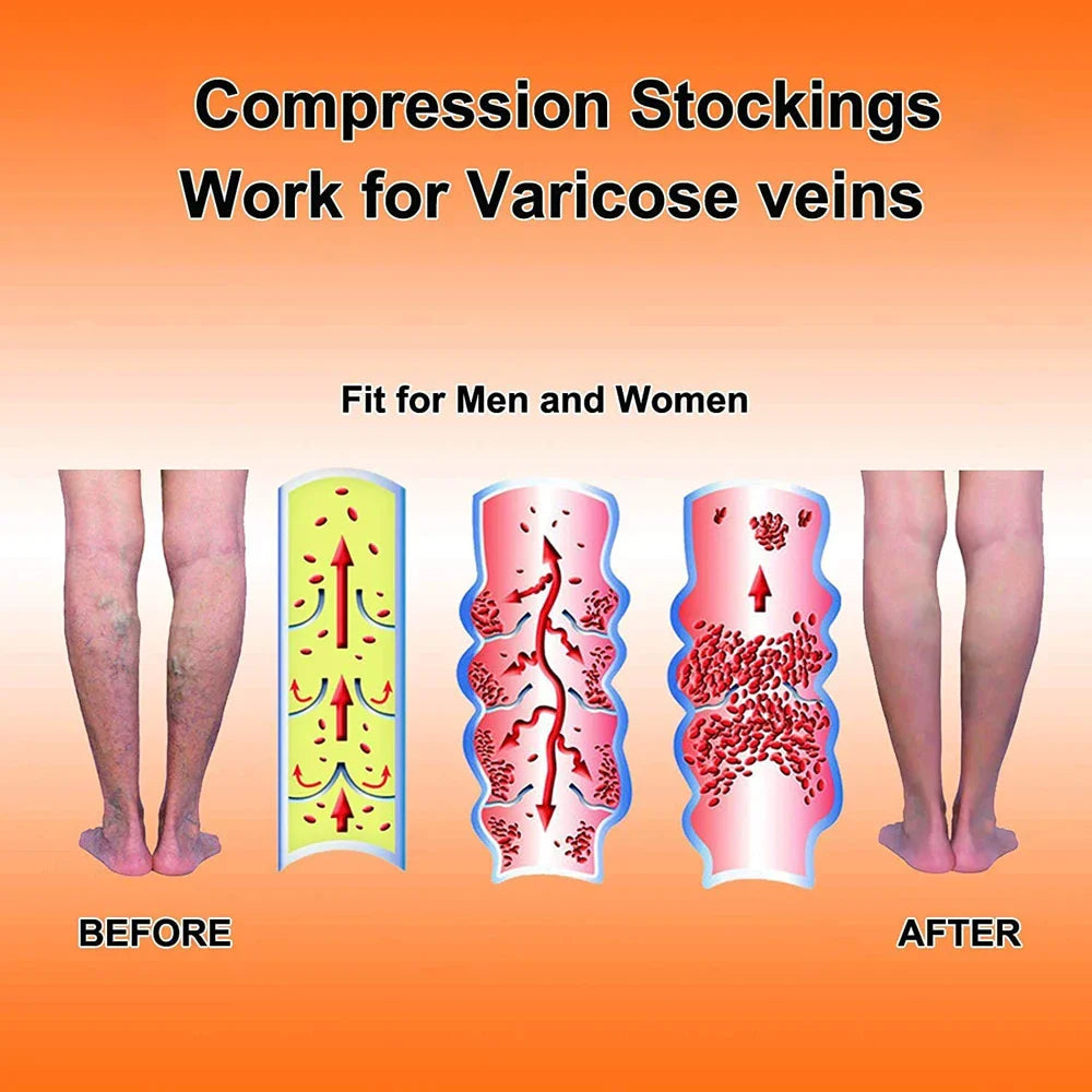Manchons de Compression Médical pour Mollets - Traitement Varices)
