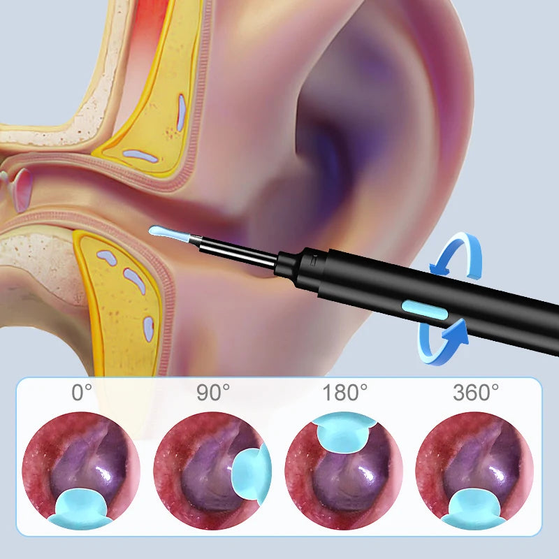 Otoscope WiFi 4,2 mm 1080P HD - Caméra Endoscopique pour Nettoyage d'Oreilles - Outils OFFERTS