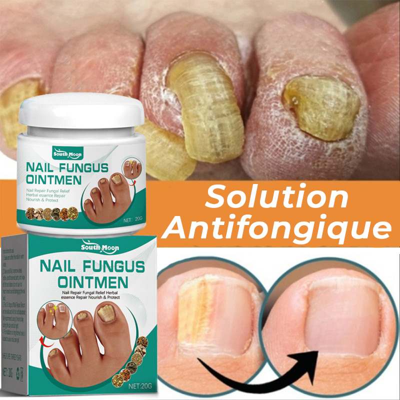 Solution Antifongique - Mycose Ongles