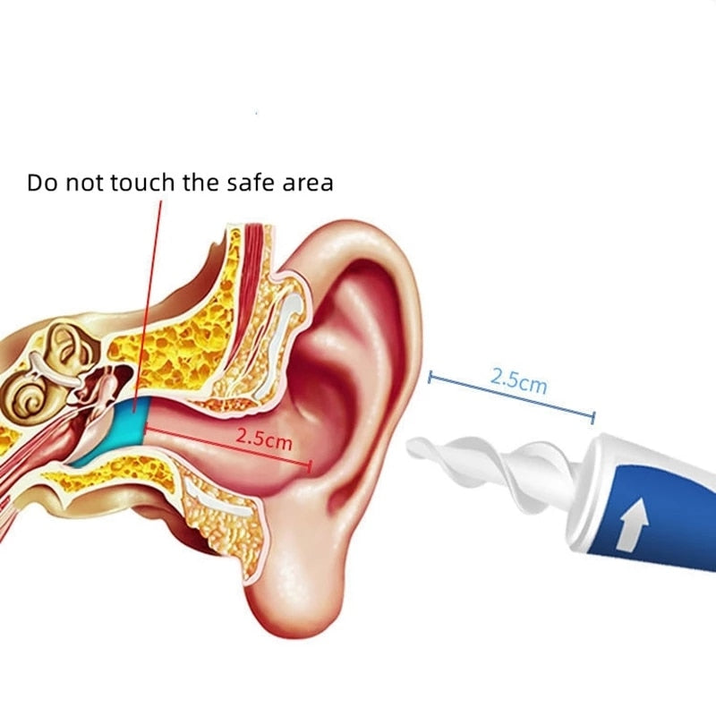 Nettoyeur d'oreille spirale réutilisable - Anti-douleur